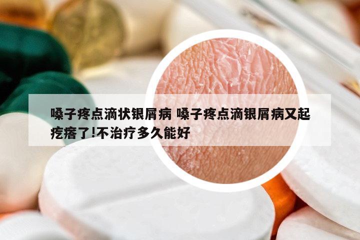 嗓子疼點滴狀銀屑病 嗓子疼點滴銀屑病又起疙瘩了!不治療多久能好