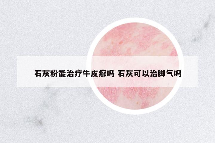 石灰粉能治療牛皮癬嗎 石灰可以治腳氣嗎