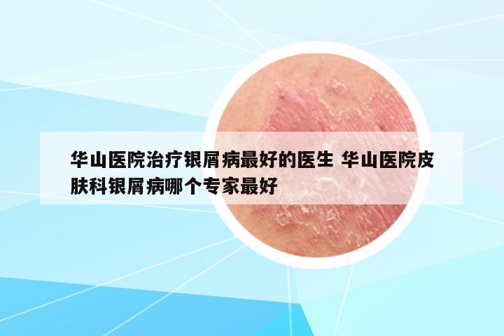 華山醫(yī)院治療銀屑病最好的醫(yī)生 華山醫(yī)院皮膚科銀屑病哪個專家最好