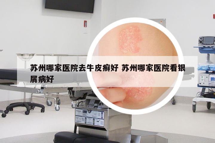 蘇州哪家醫(yī)院去牛皮癬好 蘇州哪家醫(yī)院看銀屑病好
