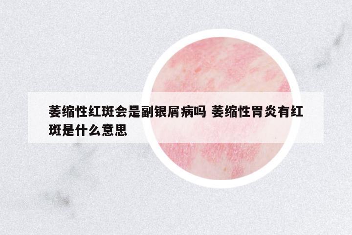 萎縮性紅斑會是副銀屑病嗎 萎縮性胃炎有紅斑是什么意思