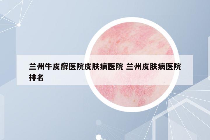 蘭州牛皮癬醫(yī)院皮膚病醫(yī)院 蘭州皮膚病醫(yī)院排名