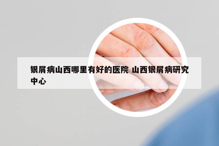 銀屑病山西哪里有好的醫(yī)院 山西銀屑病研究中心