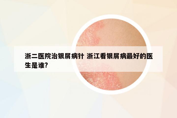 浙二醫(yī)院治銀屑病針 浙江看銀屑病最好的醫(yī)生是誰?