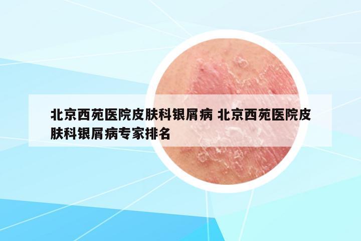 北京西苑醫(yī)院皮膚科銀屑病 北京西苑醫(yī)院皮膚科銀屑病專家排名