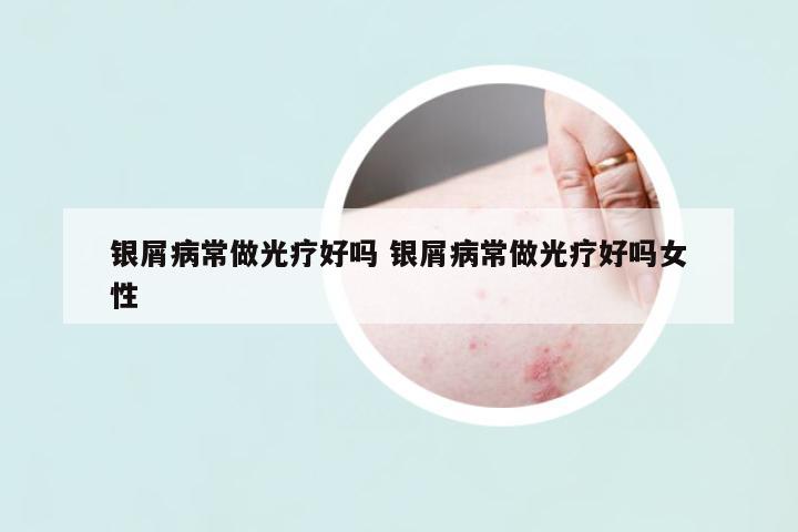 銀屑病常做光療好嗎 銀屑病常做光療好嗎女性