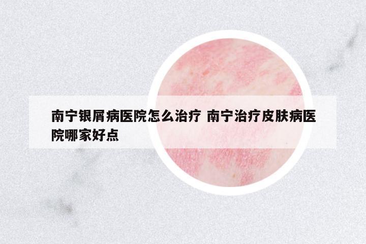南寧銀屑病醫(yī)院怎么治療 南寧治療皮膚病醫(yī)院哪家好點(diǎn)