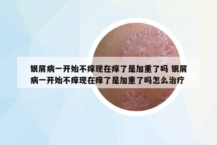 銀屑病一開始不癢現(xiàn)在癢了是加重了嗎 銀屑病一開始不癢現(xiàn)在癢了是加重了嗎怎么治療