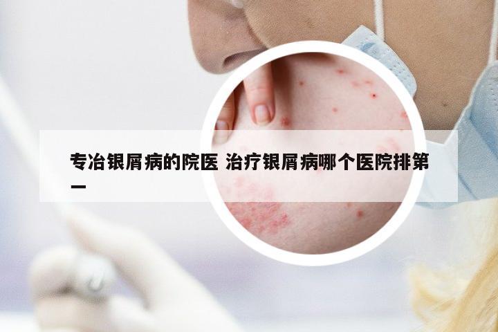 專冶銀屑病的院醫(yī) 治療銀屑病哪個(gè)醫(yī)院排第一