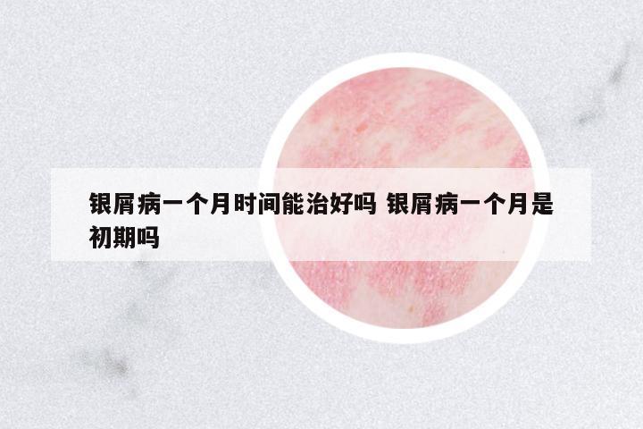 銀屑病一個月時間能治好嗎 銀屑病一個月是初期嗎