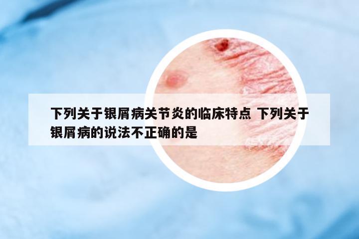 下列關(guān)于銀屑病關(guān)節(jié)炎的臨床特點(diǎn) 下列關(guān)于銀屑病的說法不正確的是