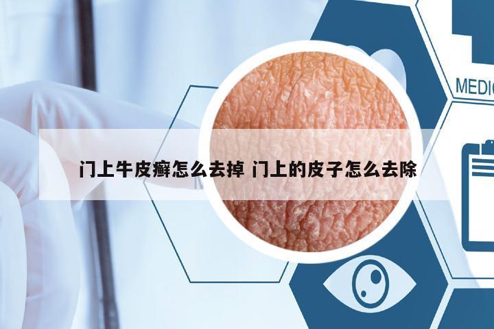 門上牛皮癬怎么去掉 門上的皮子怎么去除