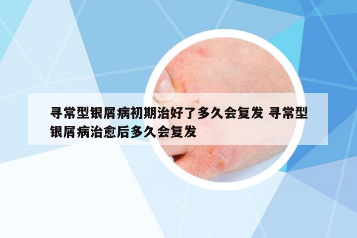 尋常型銀屑病初期治好了多久會(huì)復(fù)發(fā) 尋常型銀屑病治愈后多久會(huì)復(fù)發(fā)