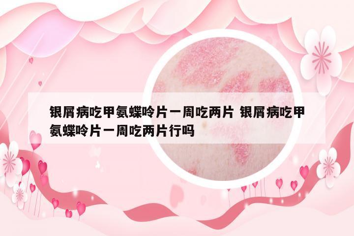 銀屑病吃甲氨蝶呤片一周吃兩片 銀屑病吃甲氨蝶呤片一周吃兩片行嗎