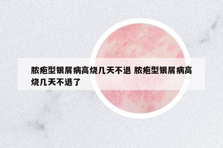 膿皰型銀屑病高燒幾天不退 膿皰型銀屑病高燒幾天不退了