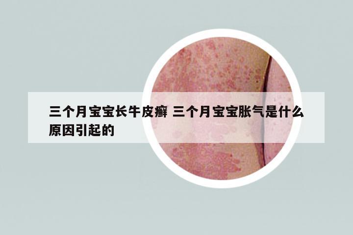 三個(gè)月寶寶長(zhǎng)牛皮癬 三個(gè)月寶寶脹氣是什么原因引起的