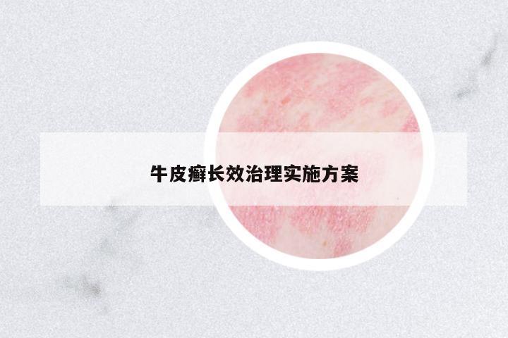 牛皮癬長效治理實施方案