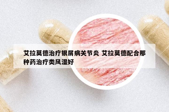 艾拉莫德治療銀屑病關節(jié)炎 艾拉莫德配合那種藥治療類風濕好