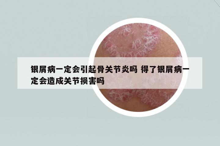 銀屑病一定會引起骨關(guān)節(jié)炎嗎 得了銀屑病一定會造成關(guān)節(jié)損害嗎