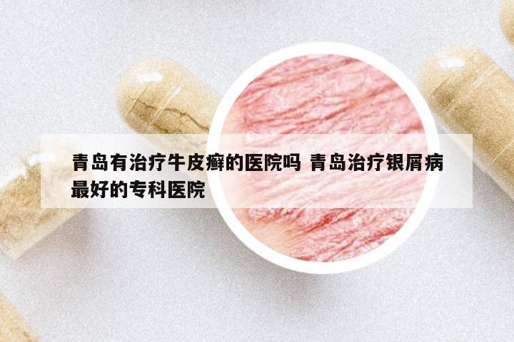 青島有治療牛皮癬的醫(yī)院嗎 青島治療銀屑病最好的專科醫(yī)院