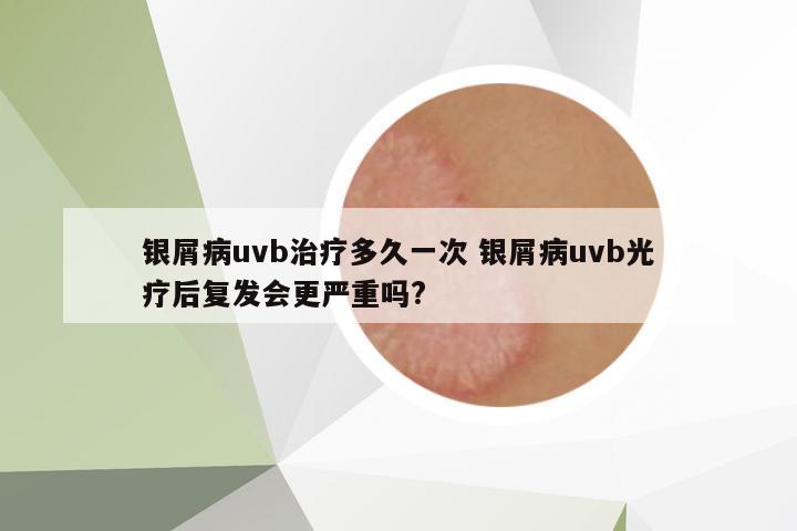 銀屑病uvb治療多久一次 銀屑病uvb光療后復發(fā)會更嚴重嗎?