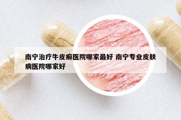 南寧治療牛皮癬醫(yī)院哪家最好 南寧專業(yè)皮膚病醫(yī)院哪家好