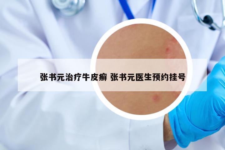 張書元治療牛皮癬 張書元醫(yī)生預(yù)約掛號(hào)