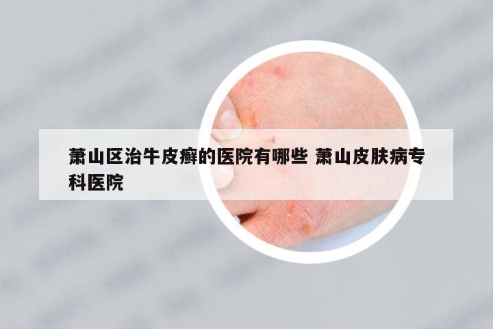 蕭山區(qū)治牛皮癬的醫(yī)院有哪些 蕭山皮膚病專科醫(yī)院