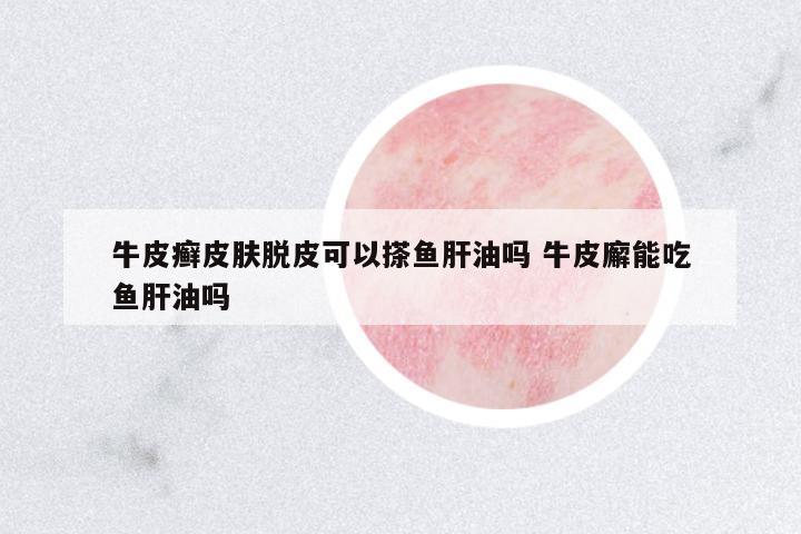 牛皮癬皮膚脫皮可以搽魚肝油嗎 牛皮廨能吃魚肝油嗎