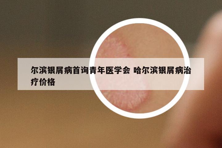 爾濱銀屑病首詢青年醫(yī)學(xué)會(huì) 哈爾濱銀屑病治療價(jià)格