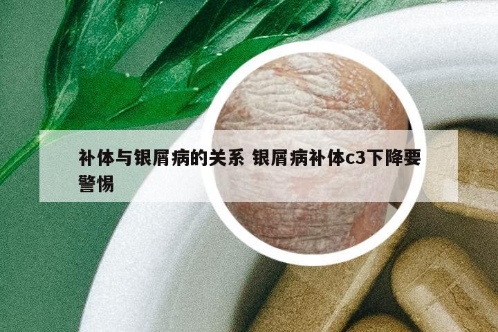 補(bǔ)體與銀屑病的關(guān)系 銀屑病補(bǔ)體c3下降要警惕