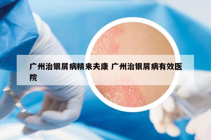 廣州治銀屑病精來夫康 廣州治銀屑病有效醫(yī)院
