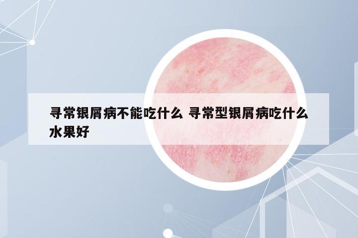 尋常銀屑病不能吃什么 尋常型銀屑病吃什么水果好