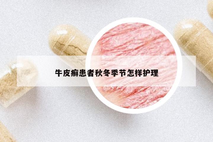 牛皮癬患者秋冬季節(jié)怎樣護理