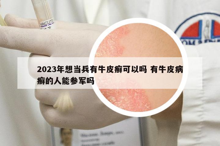 2023年想當(dāng)兵有牛皮癬可以嗎 有牛皮病癬的人能參軍嗎