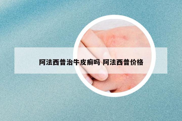 阿法西普治牛皮癬嗎 阿法西普價格