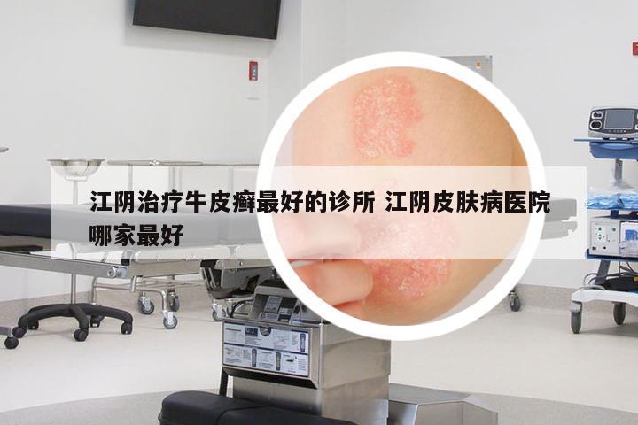 江陰治療牛皮癬最好的診所 江陰皮膚病醫(yī)院哪家最好