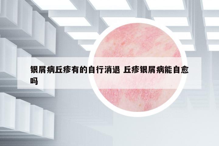 銀屑病丘疹有的自行消退 丘疹銀屑病能自愈嗎