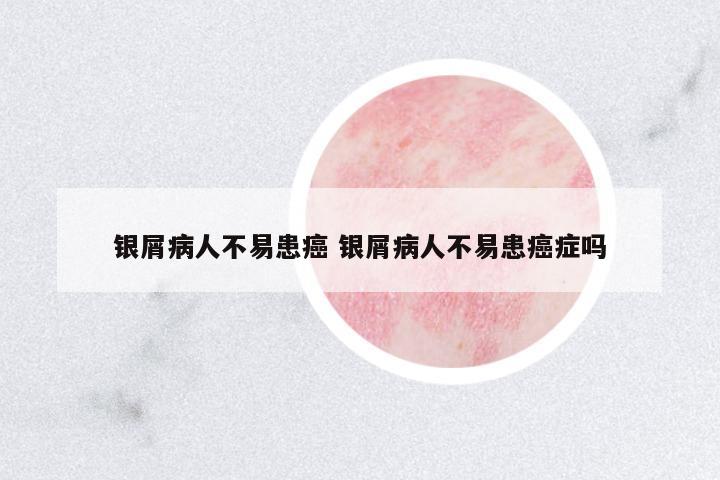 銀屑病人不易患癌 銀屑病人不易患癌癥嗎