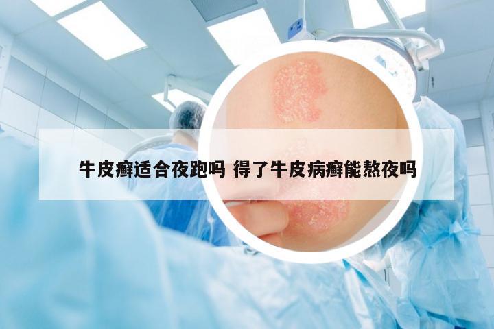 牛皮癬適合夜跑嗎 得了牛皮病癬能熬夜嗎