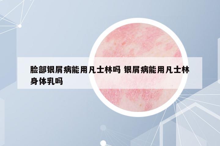 臉部銀屑病能用凡士林嗎 銀屑病能用凡士林身體乳嗎