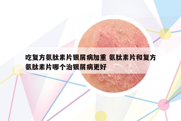 吃復方氨肽素片銀屑病加重 氨肽素片和復方氨肽素片哪個治銀屑病更好