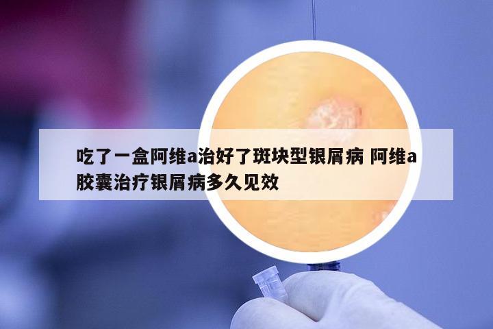 吃了一盒阿維a治好了斑塊型銀屑病 阿維a膠囊治療銀屑病多久見效