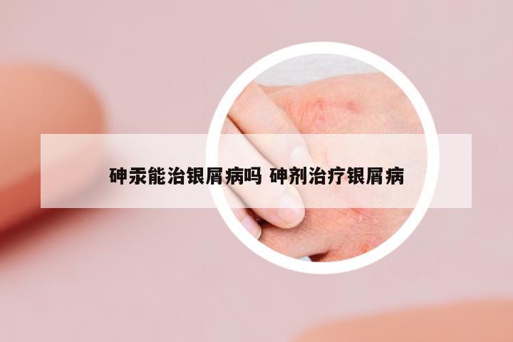 砷汞能治銀屑病嗎 砷劑治療銀屑病