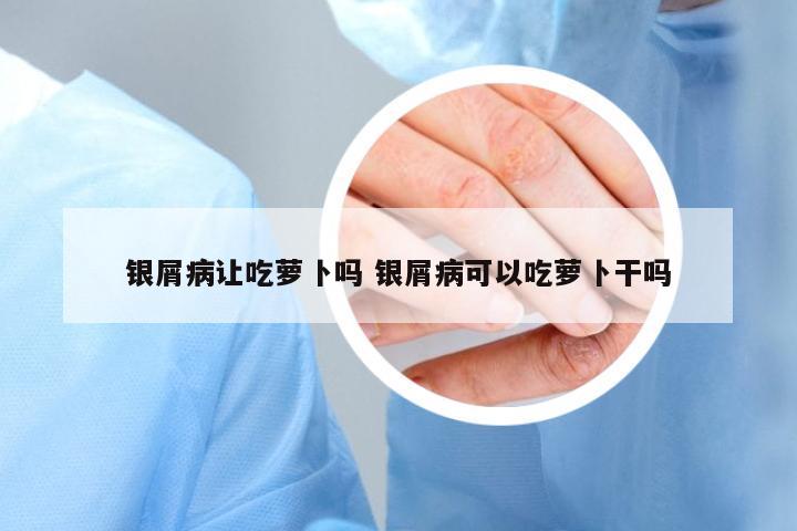 銀屑病讓吃蘿卜嗎 銀屑病可以吃蘿卜干嗎