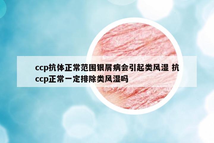 ccp抗體正常范圍銀屑病會引起類風(fēng)濕 抗ccp正常一定排除類風(fēng)濕嗎