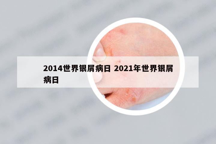 2014世界銀屑病日 2021年世界銀屑病日