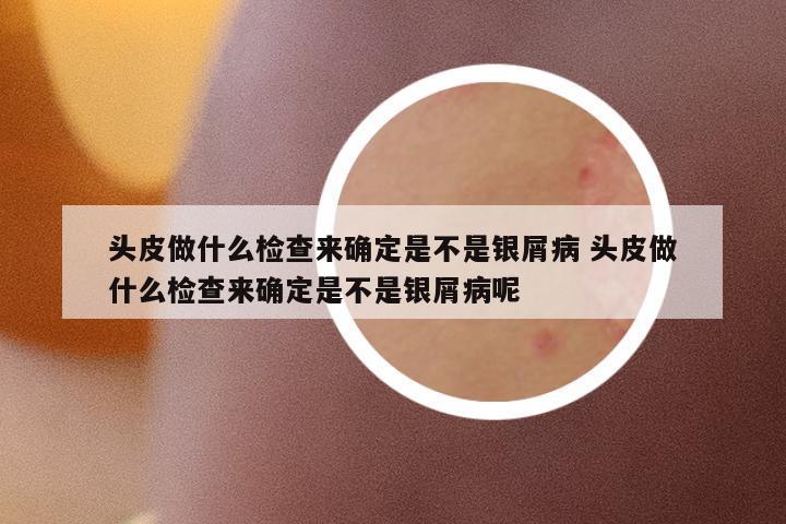 頭皮做什么檢查來確定是不是銀屑病 頭皮做什么檢查來確定是不是銀屑病呢