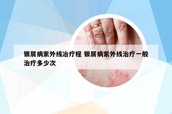 銀屑病紫外線冶療程 銀屑病紫外線治療一般治療多少次