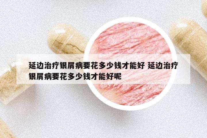 延邊治療銀屑病要花多少錢才能好 延邊治療銀屑病要花多少錢才能好呢
